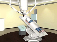 Application of Si/CdTe Compton camera to heavy iron micro surgery